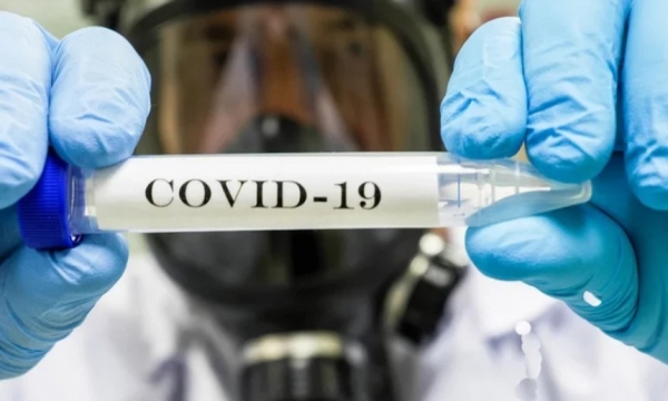 За сутки в Архангельской области подтверждено 169 новых случаев инфицирования COVID-19
